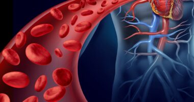 High coronary artery calcium scores risky