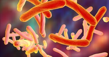 Sensitization to Aspergillus fumigatus associated with bronchiectasis in COPD patients