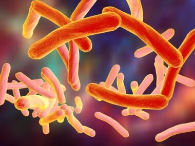 Sensitization to Aspergillus fumigatus associated with bronchiectasis in COPD patients
