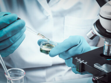 lymphotoxin beta receptor