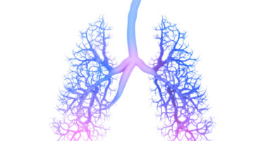 noninvasive ventilation in COPD