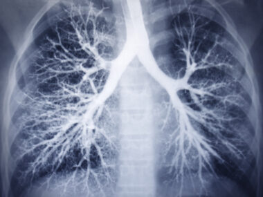 lung size and airways