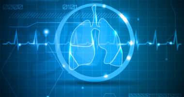 SVS trial and lung function