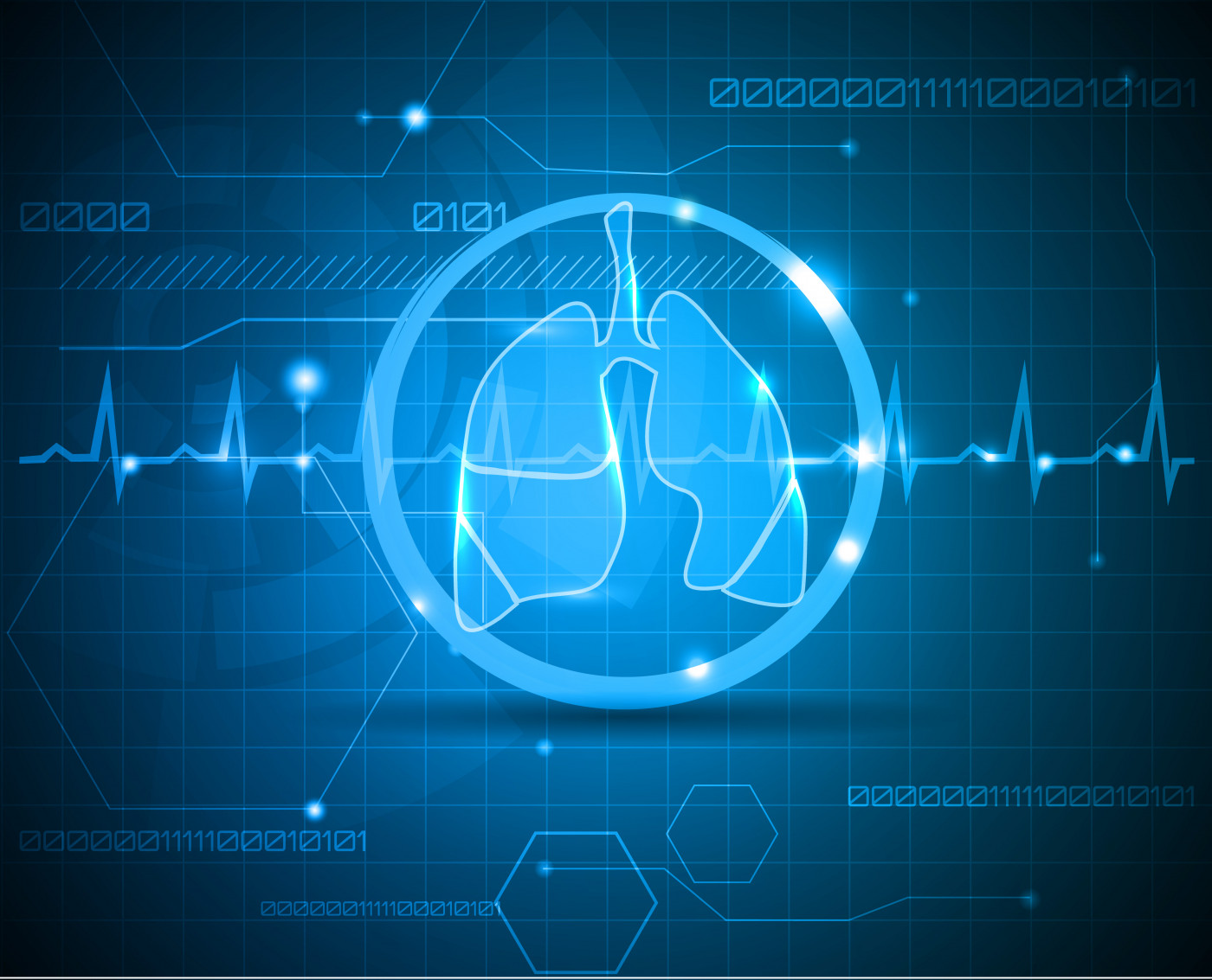 SVS trial and lung function