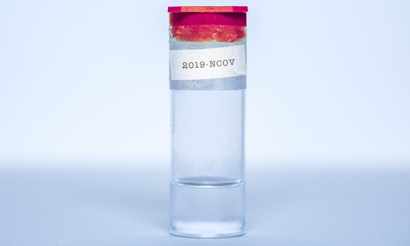 COPD, Smoking Increase Death Risk in COVID-19 Patients, Study Says COPD, Smoking Increase Death Risk in COVID-19 Patients, Study Says