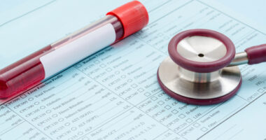 blood test for IL-32