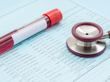 blood test for IL-32