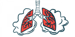 A pair of damaged lungs, with clouds of air around them, are shown.