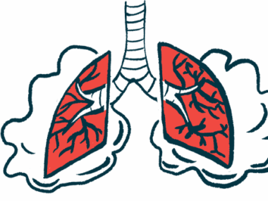 A pair of damaged lungs, with clouds of air around them, are shown.
