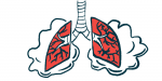 COPD shortness of breath | COPD News Today | PEP Buddy device | illustration of lungs