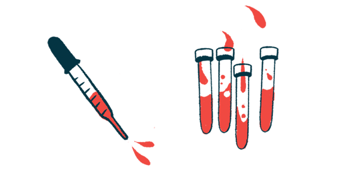 A dropper squirts blood alongside a number of vials of blood.